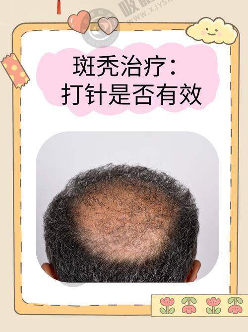 浙江百年植发医院