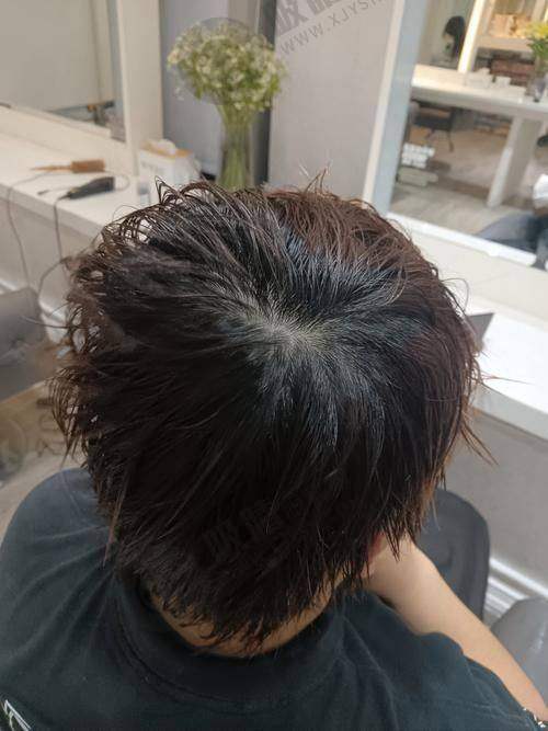 金华显赫植发专科