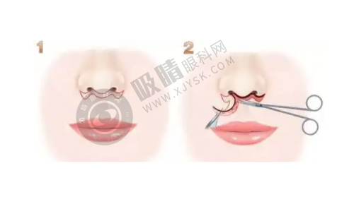 全息六维层离清奥术的优势