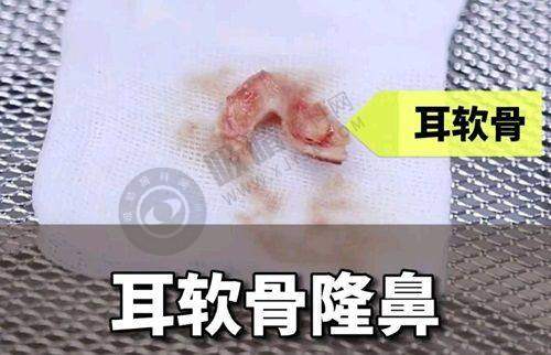 总结：广州荔湾医院取奥美定值得信赖
