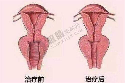 隆鼻和隆胸主推医生