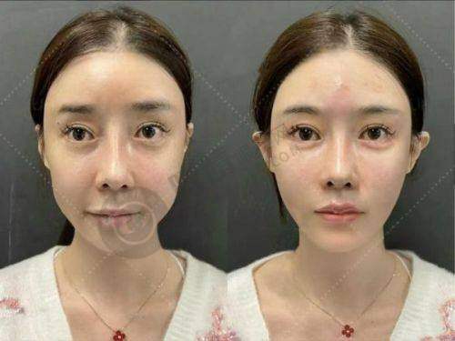 成都耳朵畸形再造哪家强？八大处/东篱/美莱技术好口碑佳！