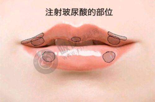 成都画美医疗美容医院优惠活动