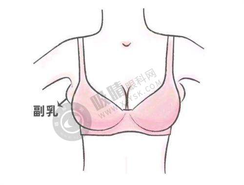 总结