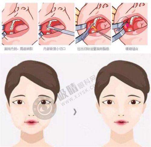 湘潭美多多美容诊所怎么样啊？——热门医美项目介绍