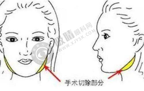 国内双眼皮修复十大名医是谁？权威榜单揭晓专家排名+医院信息