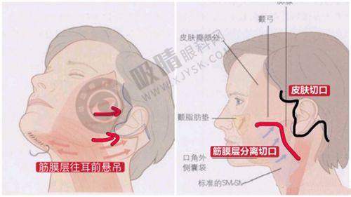 乌鲁木齐整形医院哪家强？华美隆胸+威兹曼吸脂前十榜单揭晓