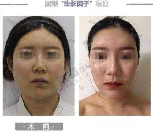 沈阳华美医院胎记疤痕科：王洪宇医生的专精实力