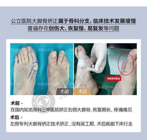 沈阳美置颜医疗美容门诊肋骨鼻综合效果好吗？张蕾医生技术优势解析，塑造自然翘鼻