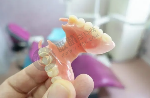 上海科特满口腔门诊部种植牙成效:患者的真实反馈