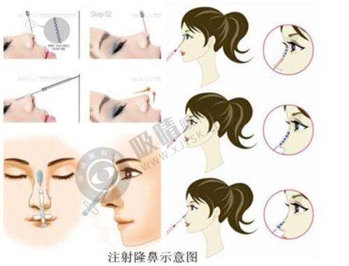 沈阳蒂美整形怎么样？5A连锁医院面部抗衰技术强，拉皮手术个性化方案口碑好