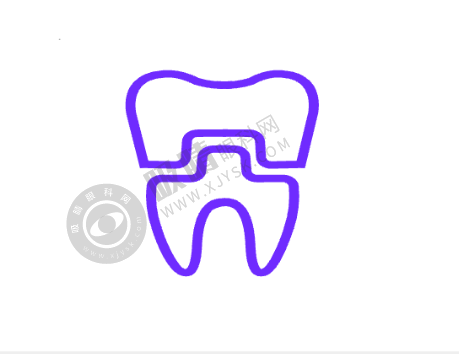 上海曙康口腔门诊部种植牙怎么样？瑞典诺贝尔种植5280元起，康钧棠院长亲诊