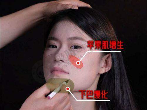总结：谨慎选择实现美丽梦想