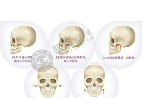 手术建议:拉萨与成都的对比