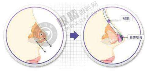 西安悦君医疗美容诊所价格表 / 收费标准