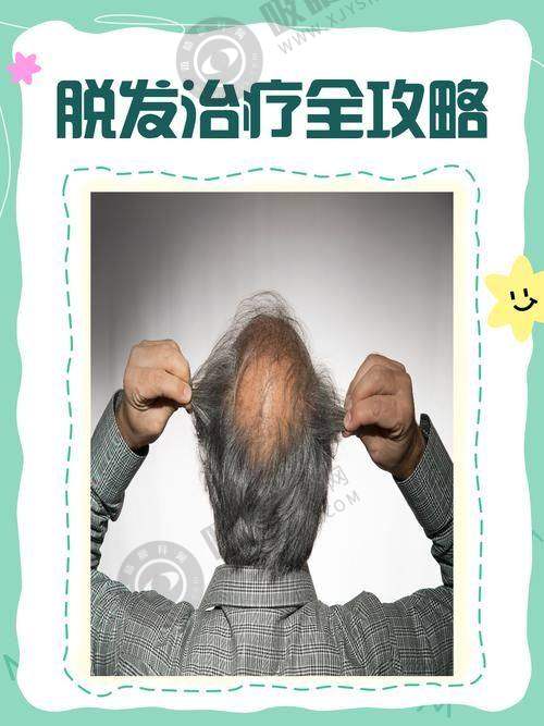 西安科美妍植发中 心来院路线