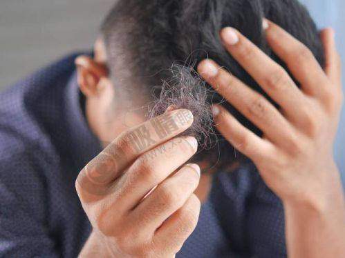 西安科美妍植发中 心患者评价