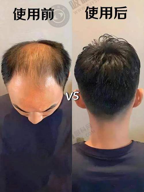 西安科美妍植发中心