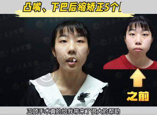 沈阳杏林美容院整形医院吸脂整形价格