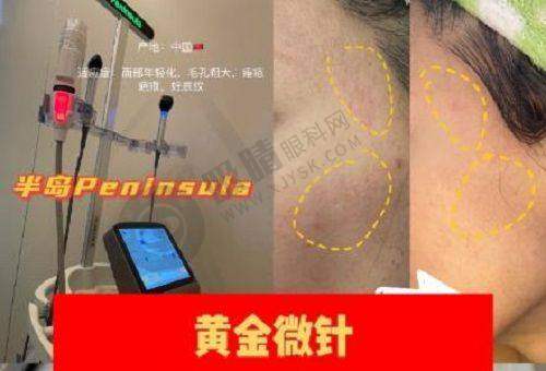 2025保定整形医院哪家强？市一中心、华美、蓝山等5家医院大揭秘！
