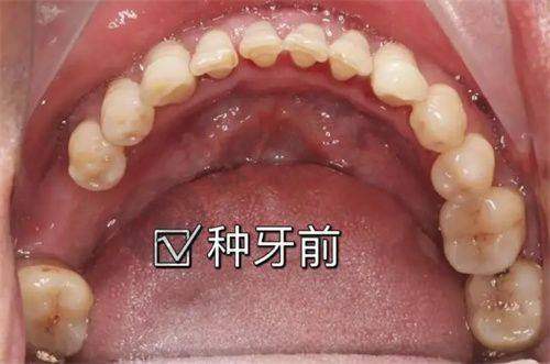 [西安交大口腔]具有影响力资质