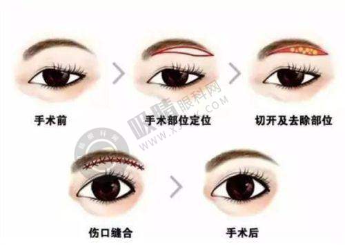 南京艺星医疗美容医院——南京特色整形机构