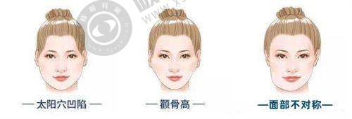 上海植发哪家强？九院、华山、瑞金三甲医院实力大比拼！