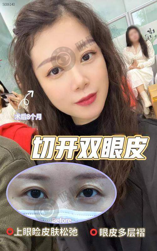 总结