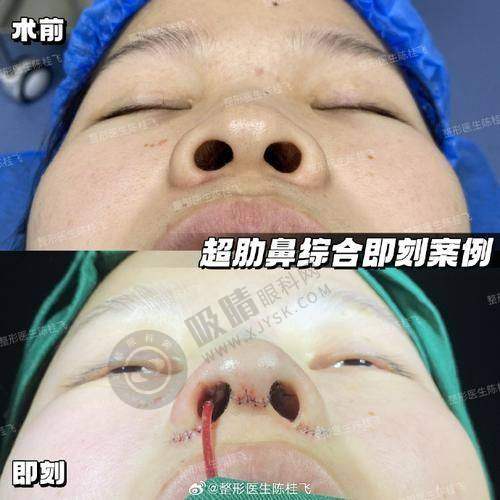 [西安伊美尔医疗美容医院]具有影响力资质