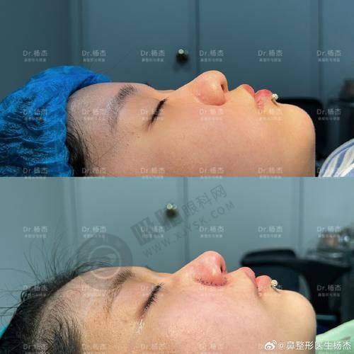 [西安伊美尔医疗美容医院]坐诊指南