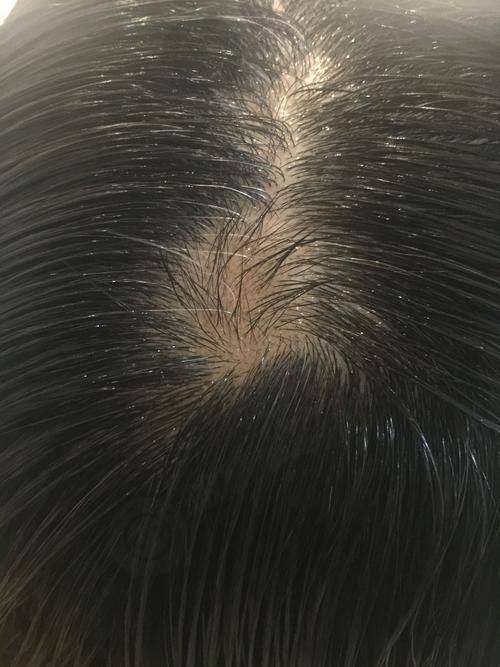 [西安沐森植发医疗诊所]特色项目及技术优势