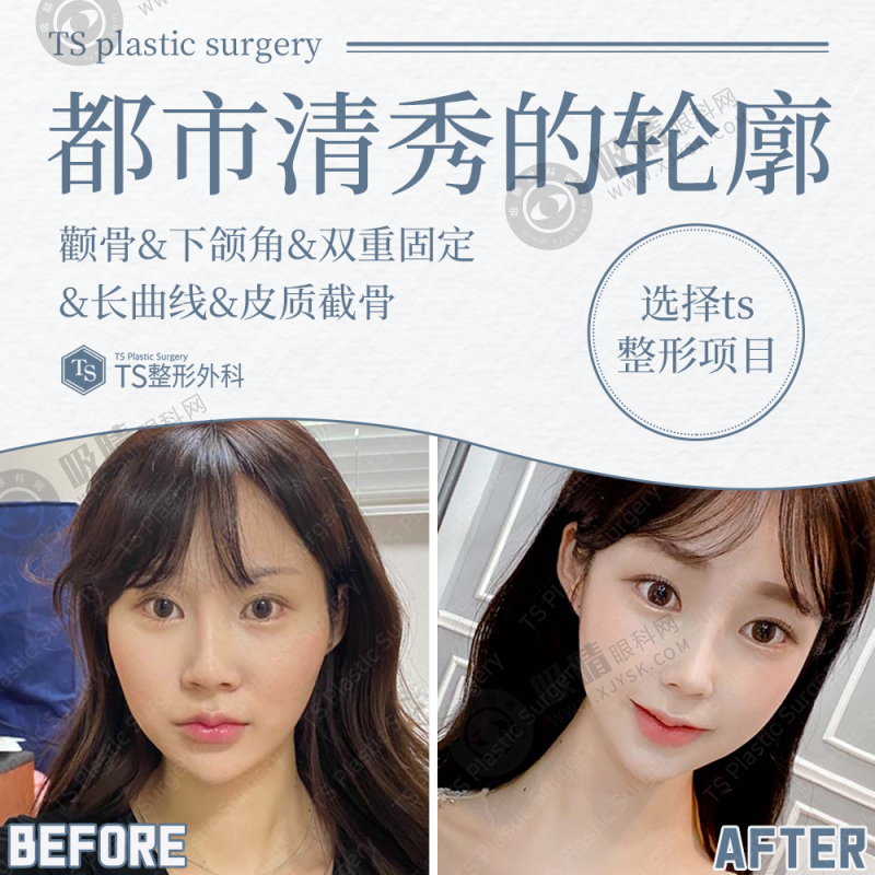 沈阳杏林美容院整形医院激光美肤价格