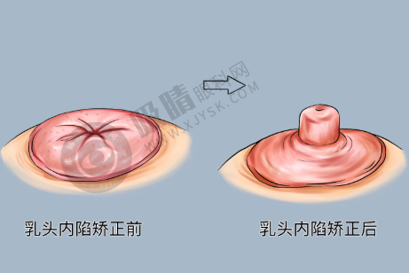 惠州天成医疗美容门诊部——技术雄厚的整形之选