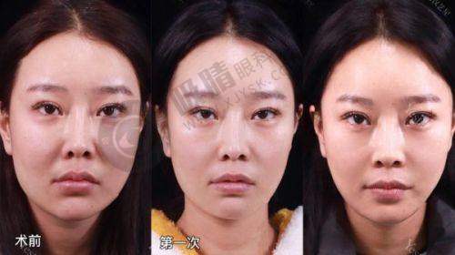 选择适合自己的深圳美容院