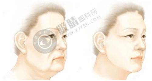 西安整形医院哪家好？国医/艺星/米兰柏羽领衔前十正规榜单！