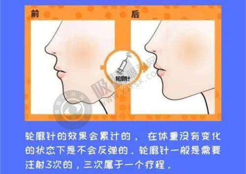 惠州瑞芙臣医疗美容门诊部——源自瑞士的整形品牌