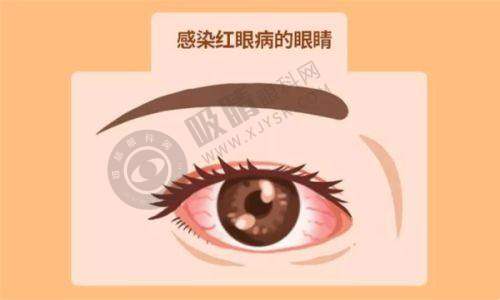 2. 河南科技大学附属医院收费标准公布：白内障手术价格