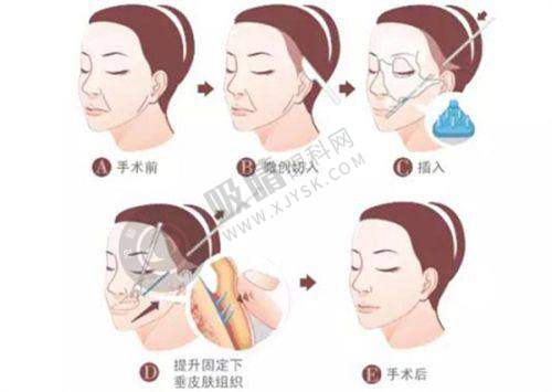 广东省人民医院（皮肤科）预约挂号流程公布：有哪些特色诊疗项目？