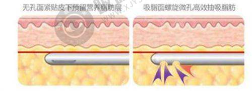 广东省人民医院（皮肤科）预约挂号流程公布：挂号方式有哪些？