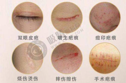 重庆医科大学附属第一医院整形美容科预约挂号流程公布：整形中心专家坐诊，在线预约享优先就诊通道