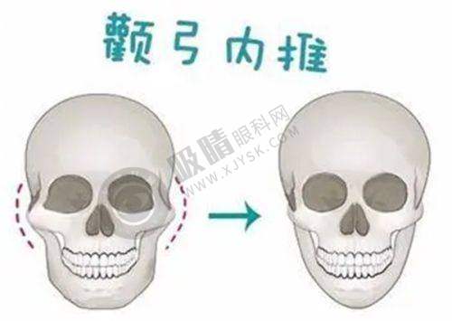 云南省第一人民医院（昆华医院）预约挂号流程公布：眼科专家在线预约，眼底病诊疗享优先通道