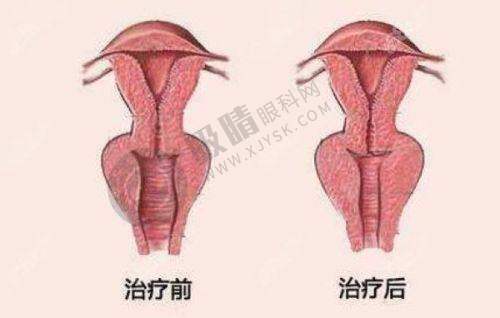4. 重庆医科大学附属第一医院整形美容科自体脂肪丰胸价格表一览