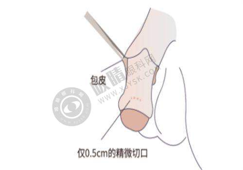 6. 影响复旦大学附属中山医院整形外科项目价格的因素