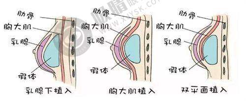 昆明医科大学第二附属医院整形科价格公开：双眼皮4000元起，鼻综合15000元起，部分项目可医保报销