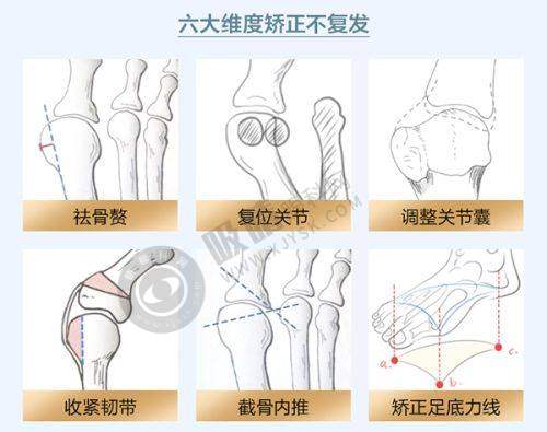 5. 云南大学附属医院（皮肤科）价格表一览之角膜塑形镜价格