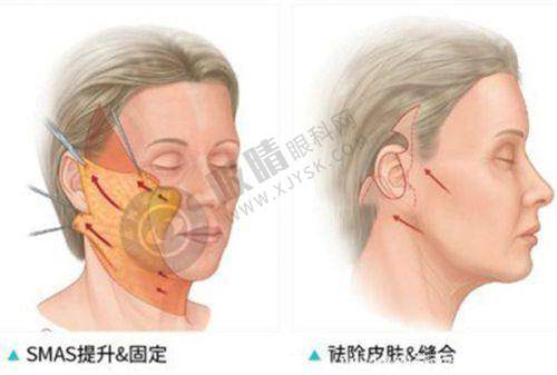 2. 昆明医 科 大学第一附属医院（医疗美容科）鼻部整形项目价格