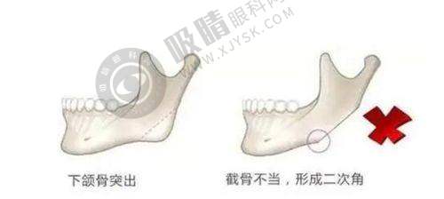 7. 云南大学附属医院（皮肤科）价格表一览之其他眼科手术及相关费用