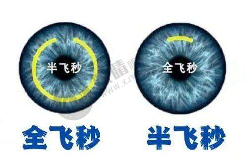 2025年北京广州贵阳阿玛施眼科哪家强？全飞秒15800元起+ICL晶体植入对比