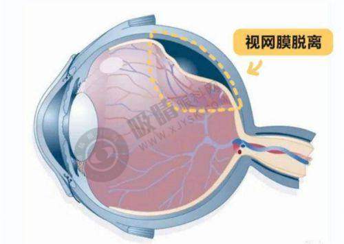 吉大二院眼科医院2025年斜视矫正手术收费明细