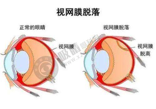 贵阳阿玛施眼科医院剖析